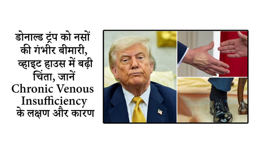 डोनाल्ड ट्रंप को नसों की गंभीर बीमारी-व्हाइट हाउस में बढ़ी चिंता | जानें Chronic Venous Insufficiency के लक्षण और कारण