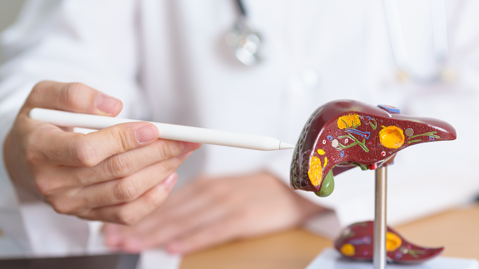 Five Symptoms of Non-Alcoholic Fatty Liver (NAFLD)