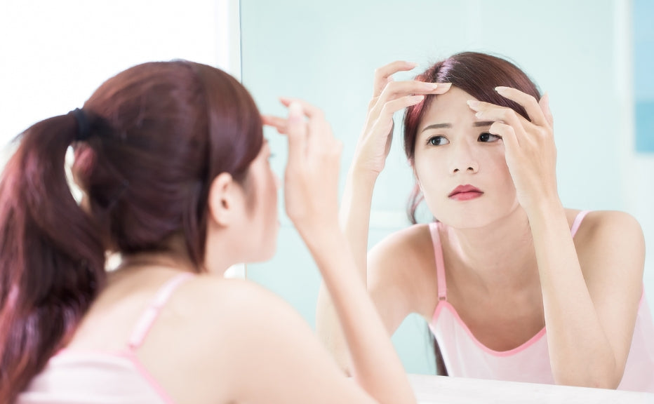 The science of menstrual acne: Causes, treatments, and prevention methods - Fytika Healthcare Products